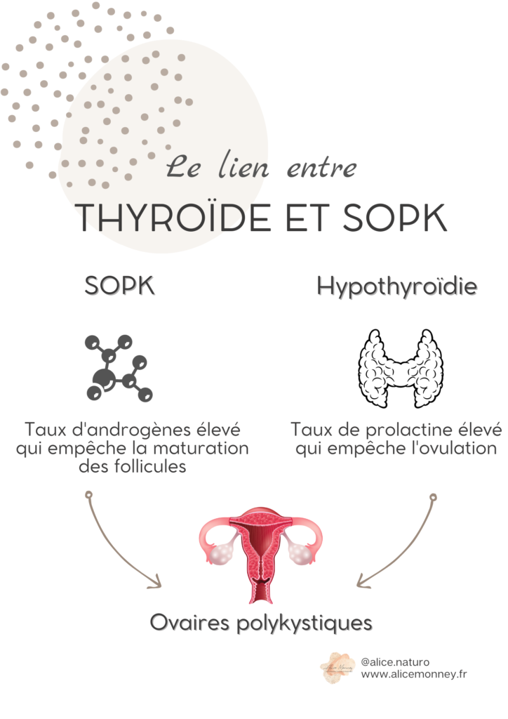 SOPK et hypothyroïdie illustration